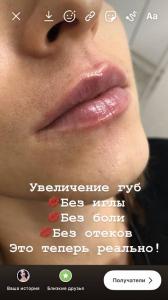 Фотография Белуччи 4